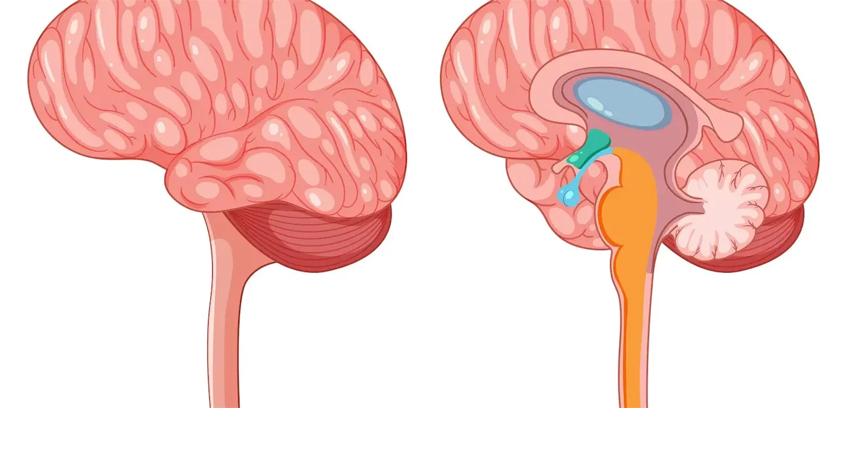 brain-cp-angle-tumor-treatment-in-lucknow.jpg